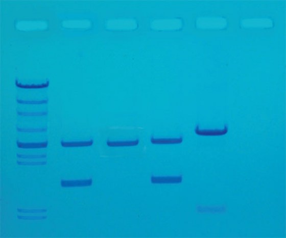 amplification-adn