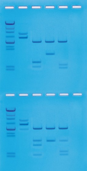 clivage-adn-lambda-enzymes