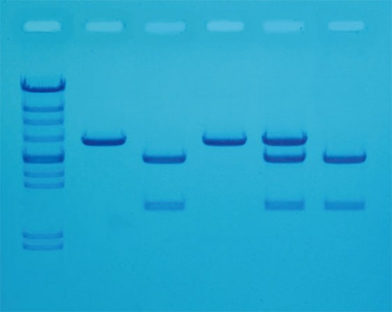 detection-cholesterol