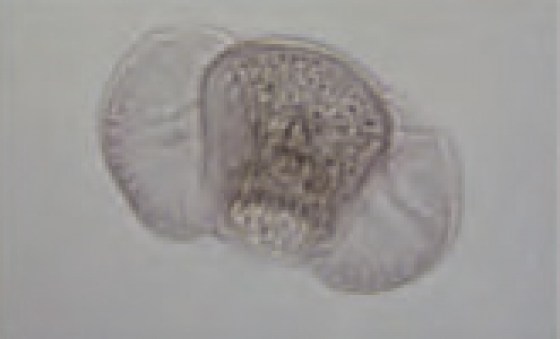 pollen21